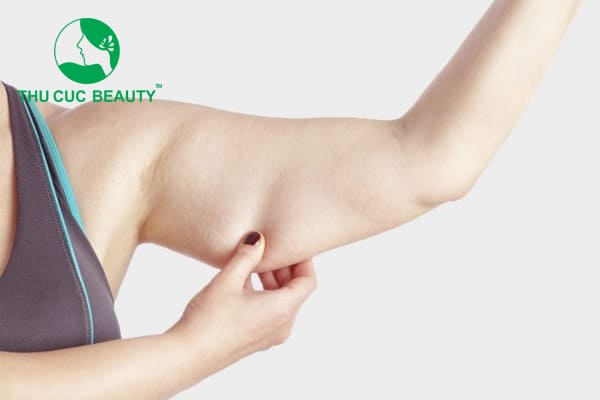Giá hút mỡ bắp tay bao nhiêu tiền?