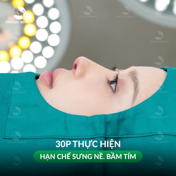 Nâng mũi tại BVTM Thu Cúc được thực hiện bởi bác sĩ chuyên môn cao, giúp mũi nhanh vào form.