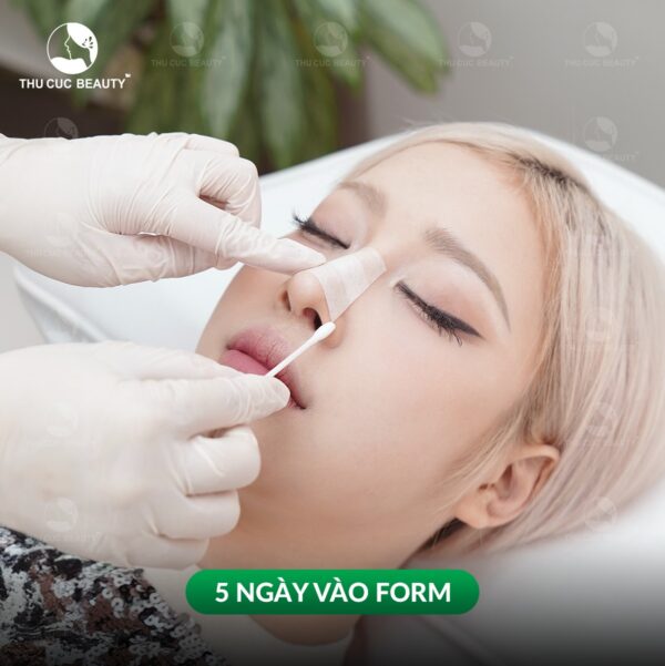 Nâng mũi tại BVTM Thu Cúc được thực hiện bởi bác sĩ chuyên môn cao, giúp mũi nhanh vào form.