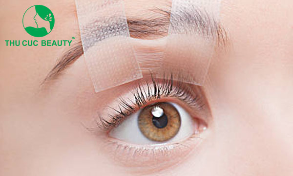 Cách khắc phục tiêm botox sụp mí mắt