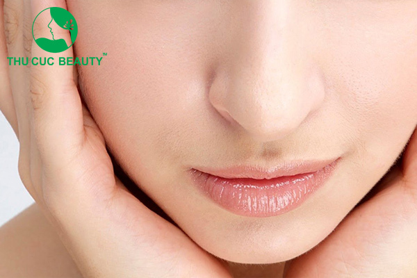 Tiêm filler rãnh cười