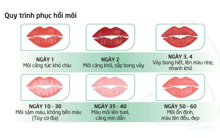 Thời gian hồi phục trung bình sau khi cấy môi sinh học.