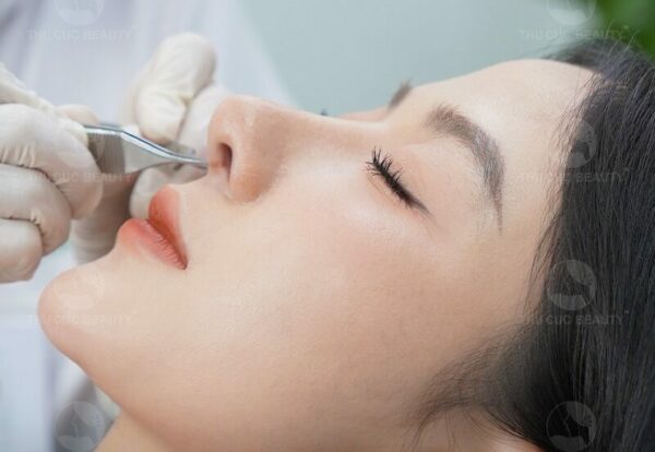 Nâng mũi là phương pháp thẩm mỹ phổ biến hiện nay.