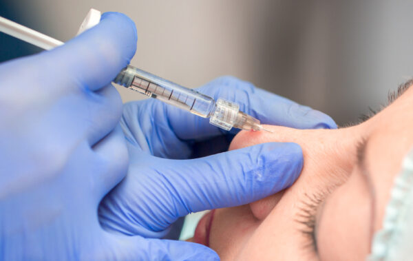 Tiêm filler mũi tự tan được không? 