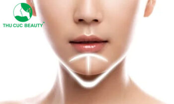 Nên độn cằm bằng chất liệu hay tiêm filler cằm?