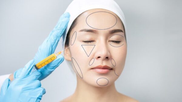 Nên tiêm filler cằm hay cấy mỡ tự thân?