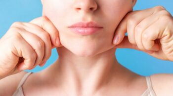 Hút mỡ má có bị xệ da không?