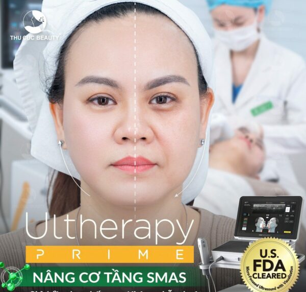 Nâng cơ mặt hiệu quả an toàn.