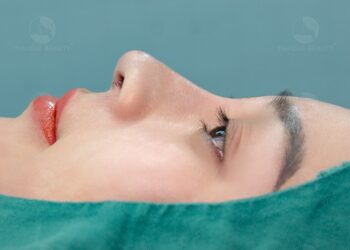 Nâng mũi mổ kín hay hở? Phương pháp nào tối ưu hơn?