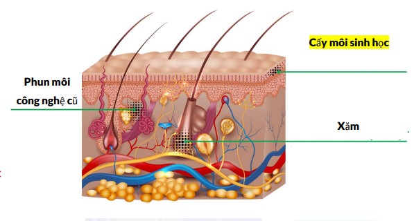 Cấy môi sinh học là kỹ thuật hiện đại, giúp môi mềm tươi tự nhiên.