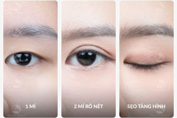 seo cat mi mat tham my e1764668715791