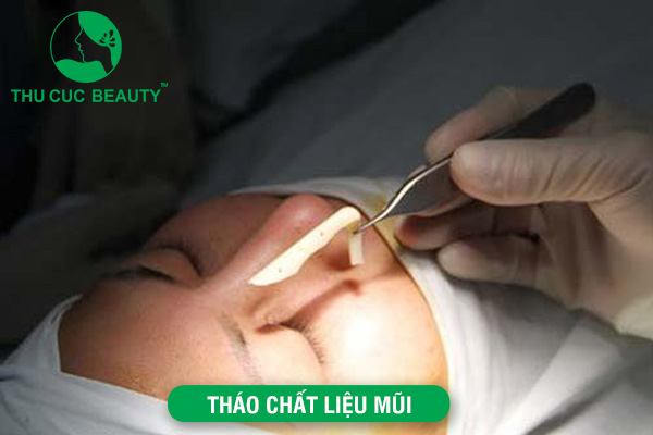 Chi phí rút chất liệu sụn mũi giá bao nhiêu?