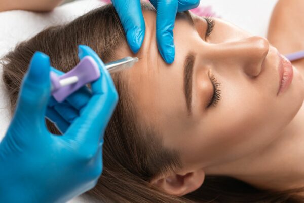 Tiêm botox xóa nhăn trán bao nhiêu tiền?