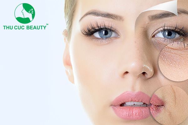 Tiêm dặm botox giúp duy trì vẻ đẹp từ lần tiêm đầu tiên.
