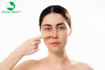 Va chạm nhẹ sau nâng mũi có sao không?