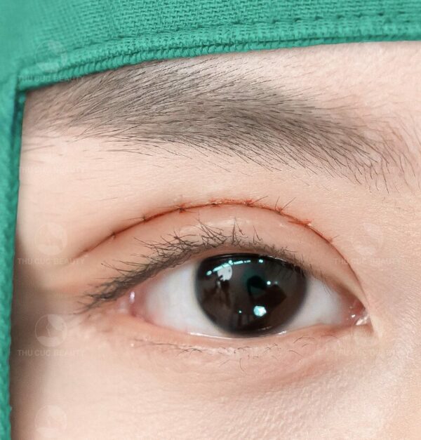 cat mat sup mi bao nhieu tien e1767954702434