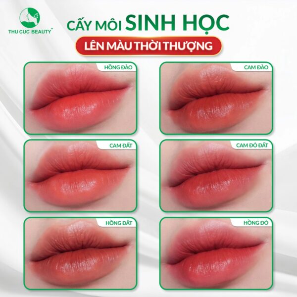Khử thâm môi có lên màu không? Bao lâu lên màu? 3 Cấy môi sinh học cho vẻ đẹp trẻ trung, thời thượng.