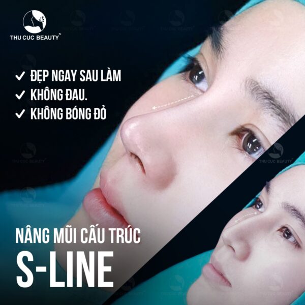 Chỉnh xương mũi gồ kết hợp nâng mũi cấu trúc sẽ cho tổng thể đẹp mãn nhãn.