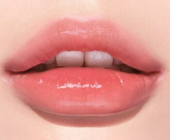 Dáng môi tiêm filler đẹp được yêu thích hiện nay