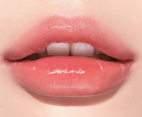 Dáng môi tiêm filler đẹp