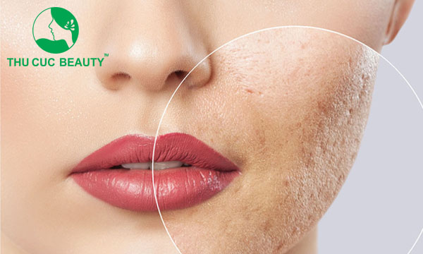 dieu tri seo hieu qua