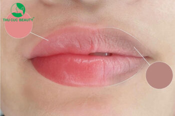 Khử thâm môi có lên màu không? Bao lâu lên màu?