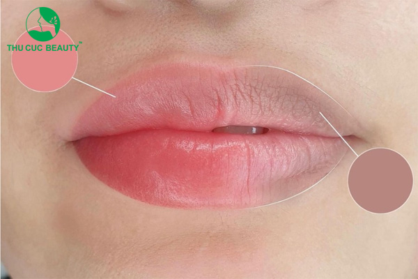 Khử thâm môi có lên màu không? Bao lâu lên màu? 1 Khử môi thâm có lên màu không?