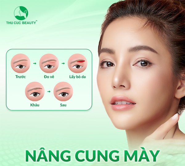 Nâng cung mày giá bao nhiêu?