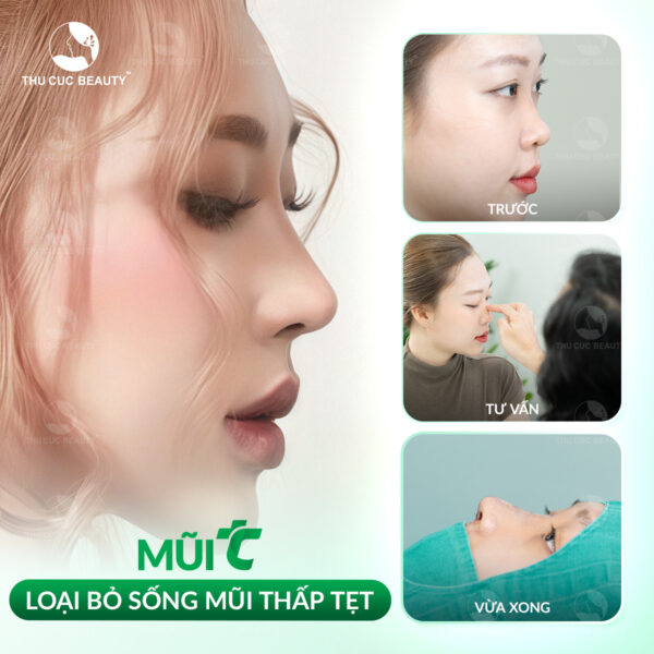 nang mui hieu qua e1767932790534