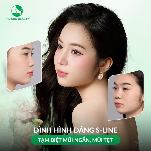 Nâng mũi S-line giá bao nhiêu?