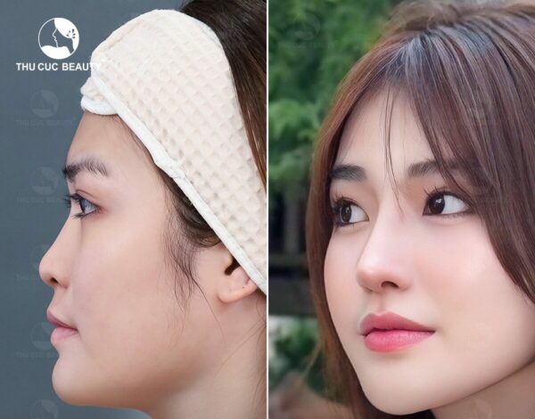 nang mui thanh cao e1767932233993