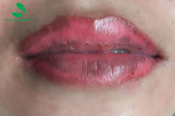 Tại sao phun môi không lên màu? 1 Nguyên nhân phun môi không lên màu.