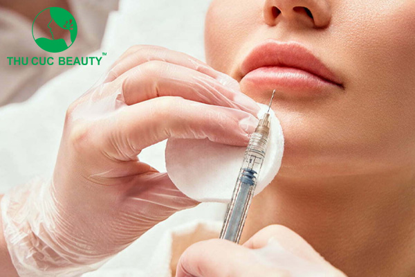 Tiêm filler môi bị sưng thường hết sau khoảng 5 - 7 ngày.