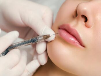 Tiêm filler môi giữ được bao lâu?