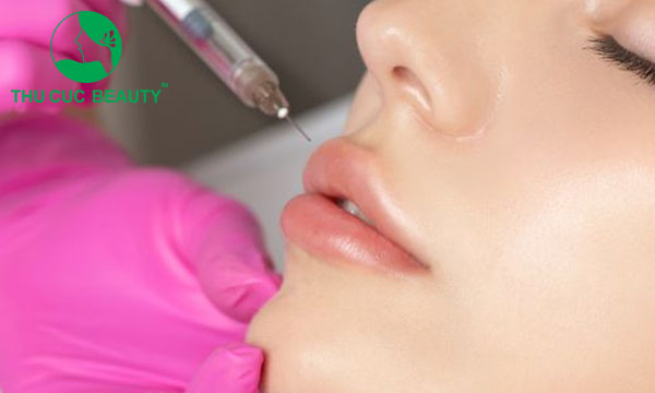 Tiêm filler môi dày