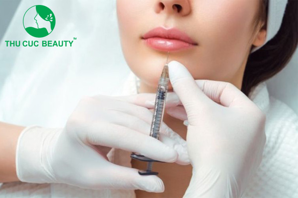 Tiêm filler môi giữ được bao lâu?