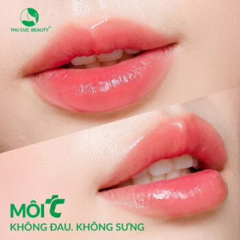 Cấy môi sinh học bao lâu thì đẹp?