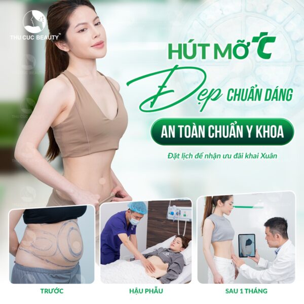 hut mo an toan tai thu cuc e1772078129293