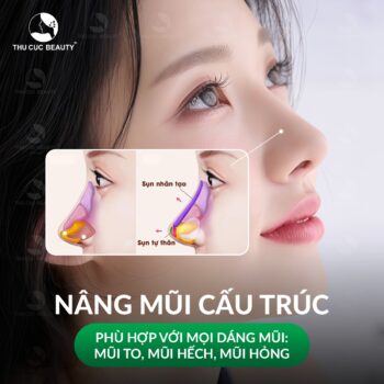 Những ai nên nâng mũi cấu trúc?