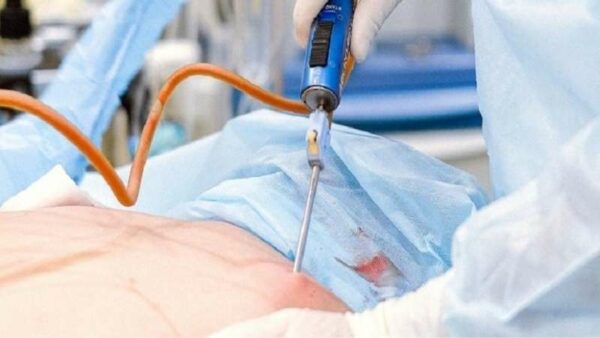 tai sao hut mo khong nen hut kiet e1772079595944