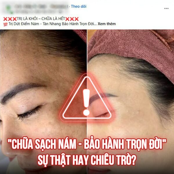 tri nam da co vinh vien khong e1770372119813