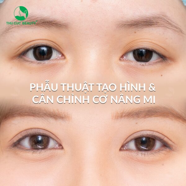 chinh co nang mi e1773474531200