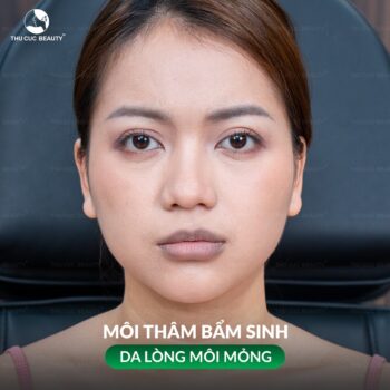 Khử thâm môi có hại không? 