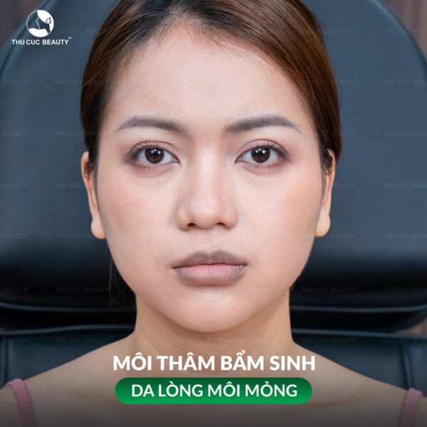 Khử thâm môi có hại không? 1 Khử thâm môi có hại không?