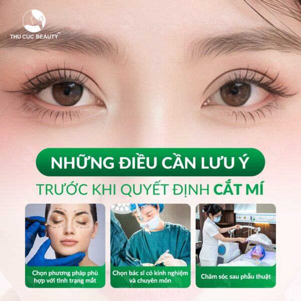 Lưu ý cần biết khi đi cắt mí