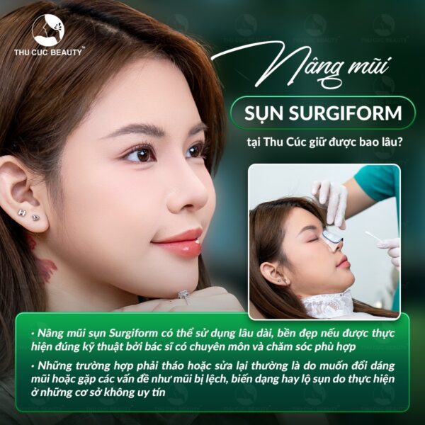 Nâng mũi sụn Surgiform bao nhiêu tiền? 4 nang mui surgiform gia bao nhieu e1772613330123