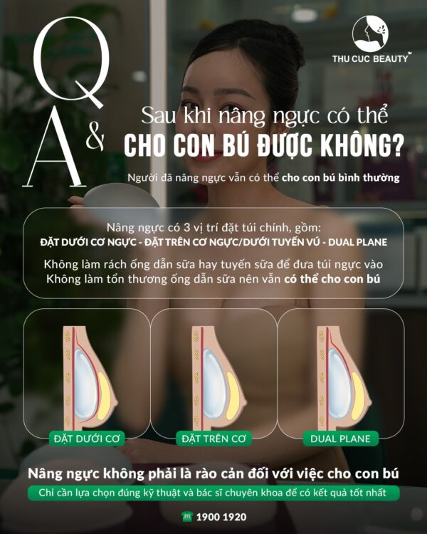 Cho con bú có làm ngực bị chảy xệ sau khi nâng ngực không? 1 Nâng ngực không làm ảnh hưởng đến khả năng cho con bú.