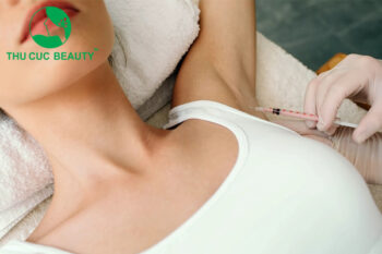 Tiêm botox trị hôi nách có hiệu quả không?