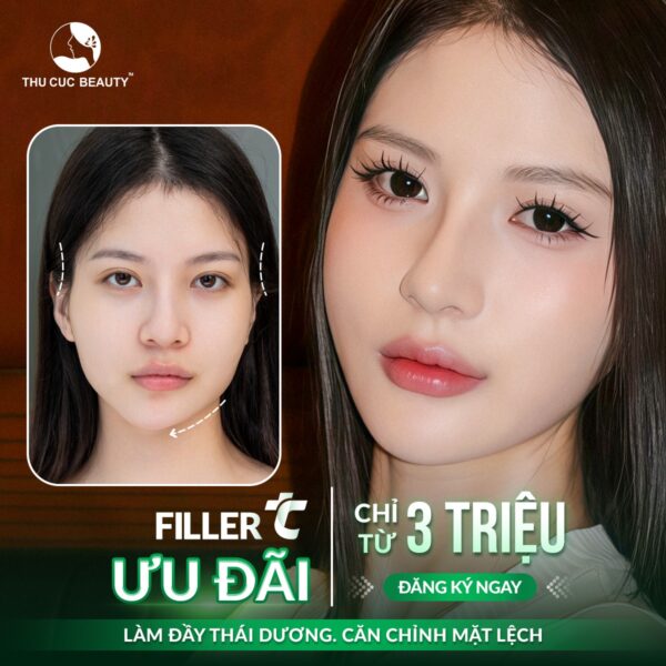 tiem cam e1773137373305