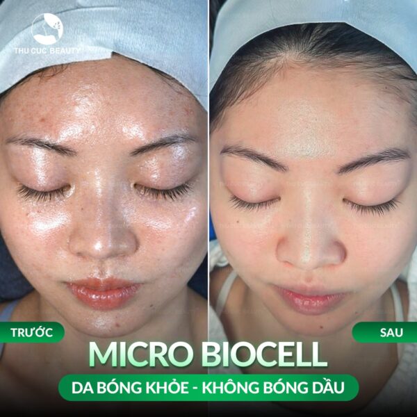 tiem meso da dau e1773998656402